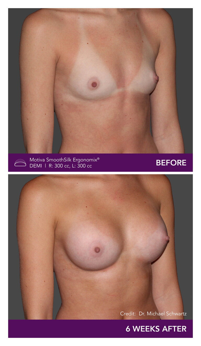 _Dr. Michael Schwartz - Patient CW Right Mobile