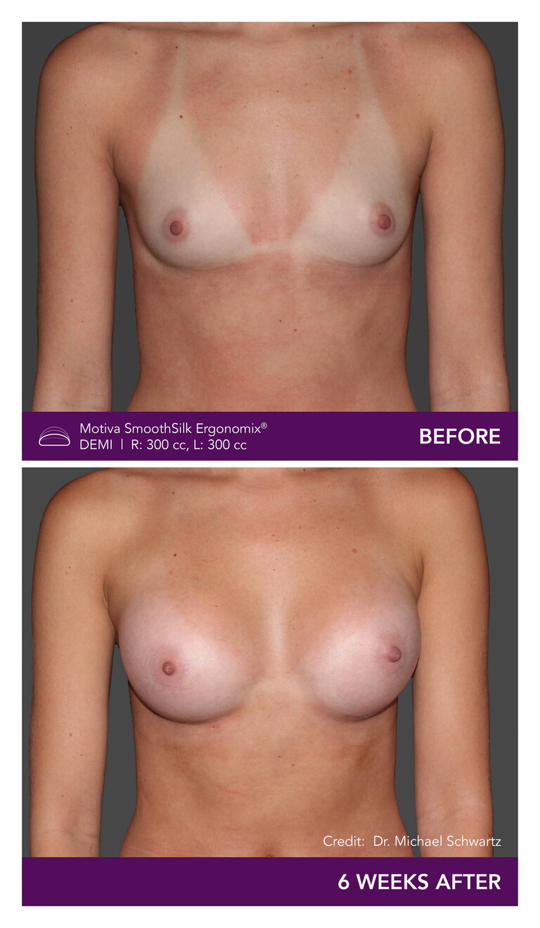 _Dr. Michael Schwartz - Patient CW Front Mobile