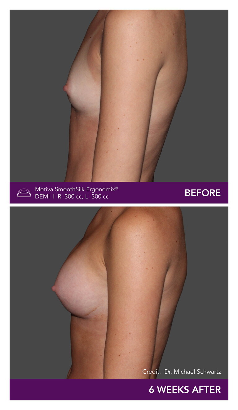 _Dr. Michael Schwartz - Patient CW Side Mobile