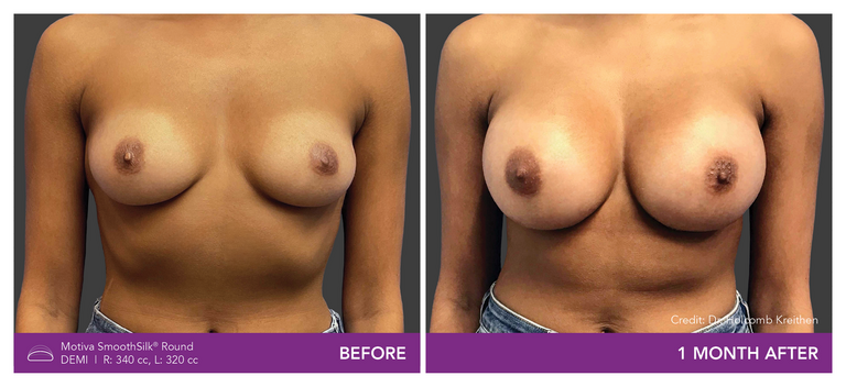 Dr. Josua Kreithen - Patient DF Front