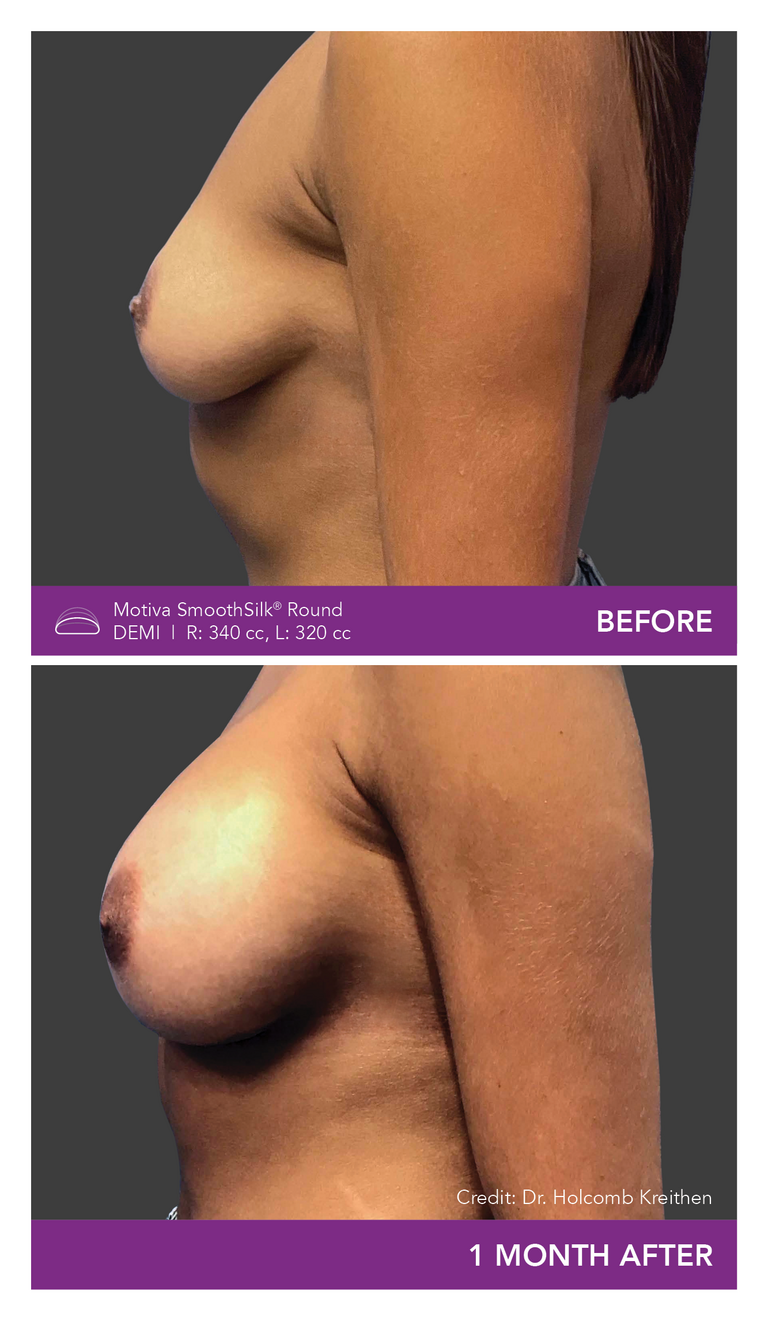 Dr. Josua Kreithen - Patient DF Side Mobile