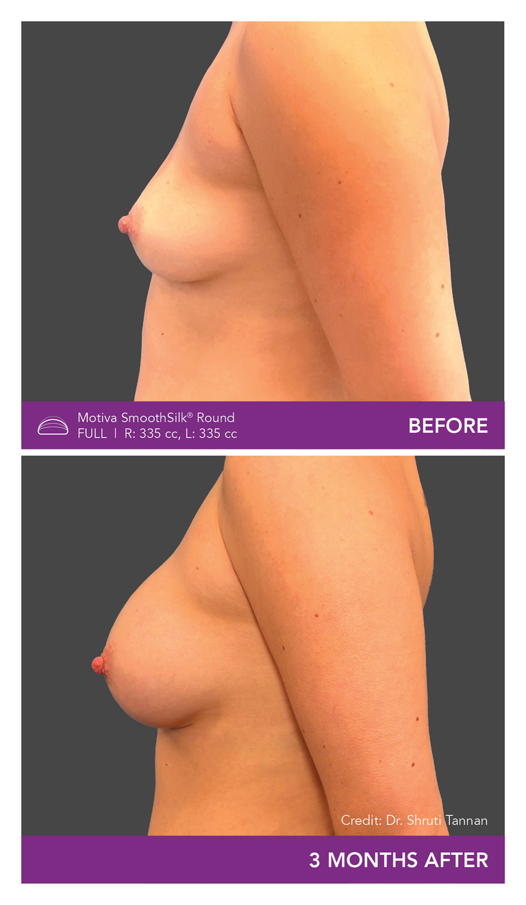 Dr. Shruti Tannan - Patient BR - Side Mobile
